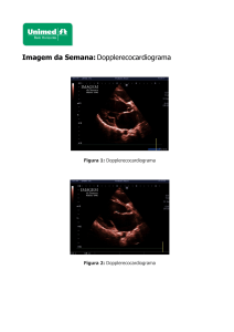 Imagem da Semana:Dopplerecocardiograma - Unimed-BH