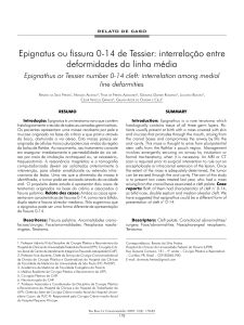Epignatus ou fissura 0-14 de Tessier: interrelação entre