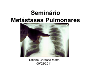 Seminário 4 – Metástases Pulmonares Arquivo