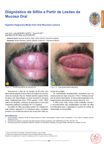 Diagnóstico de Sífilis a Partir de Lesões da Mucosa Oral