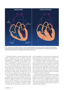 A hipertrofia cardíaca é um grave problema de saúde pública