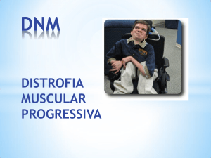 3 - distrofia muscular progressiva