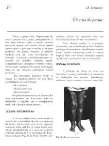 Úlceras de perna - Instituto Lauro de Souza Lima
