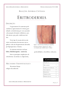 eritrodermia - Universidade de Lisboa