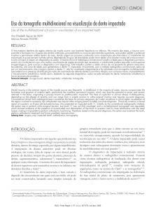 Uso da tomografia multidirecional na visualização de dente impactado