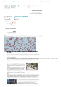 USP – SUS inclui transplante de medula óssea como tratamento