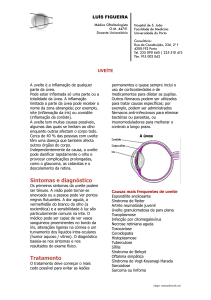 Sintomas e diagnóstico Tratamento - Imunopatologia Ocular