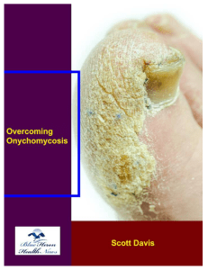 Overcoming Onychomycosis™ PDF eBook Download Free