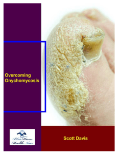 Overcoming Onychomycosis™ eBook PDF Download Free