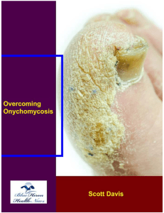 Scott Davis, Overcoming Onychomycosis™ PDF eBook