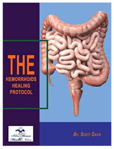 Scott Davis Program - The Hemorrhoids Healing Protocol™ eBook PDF